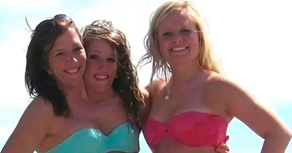 Les Sœurs Siamoises Abigail Et Brittany Enceinte